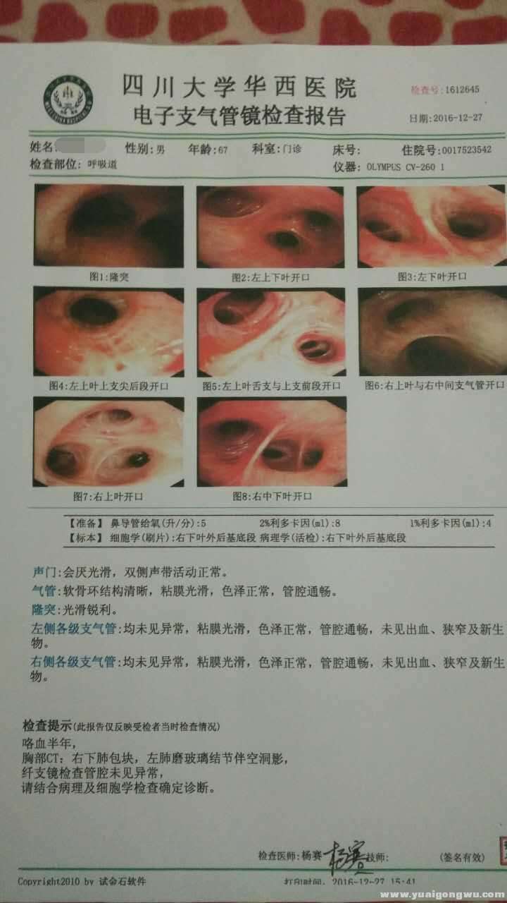 20161227华西纤支镜报告_看图王.jpg