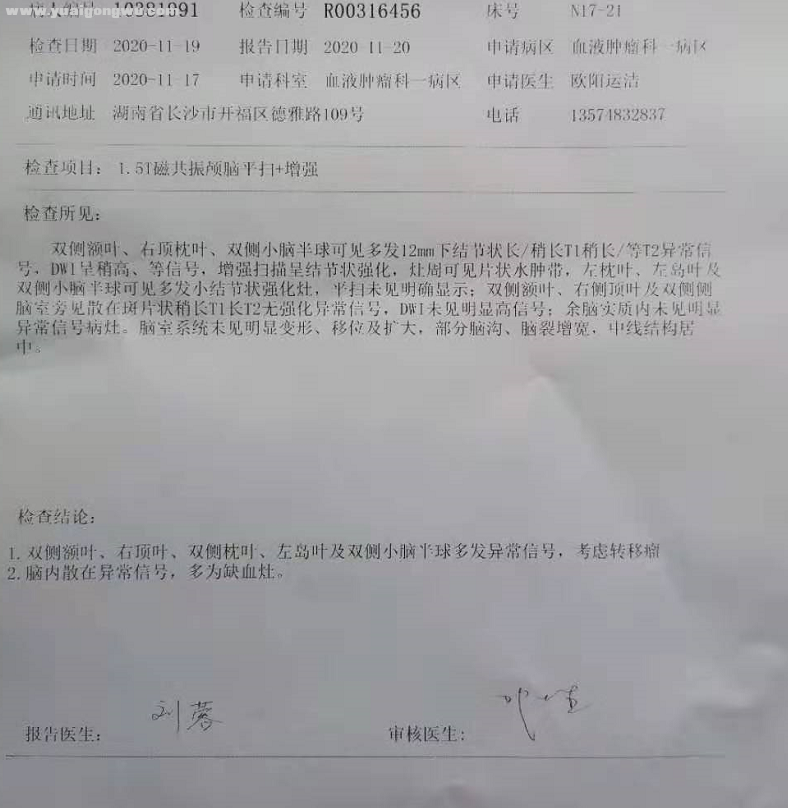 今天出来的核磁共振脑结果